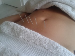 Acupunctuur Amsterdam